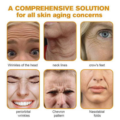 👨‍⚕️ Made and Shipped from US✅  Botox Bee Venom Wrinkle Removal Cream 20g