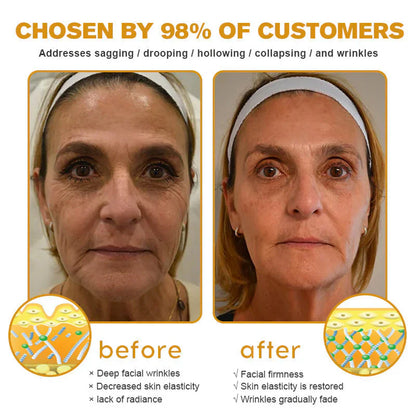 👨‍⚕️ Made and Shipped from US✅  Botox Bee Venom Wrinkle Removal Cream 20g