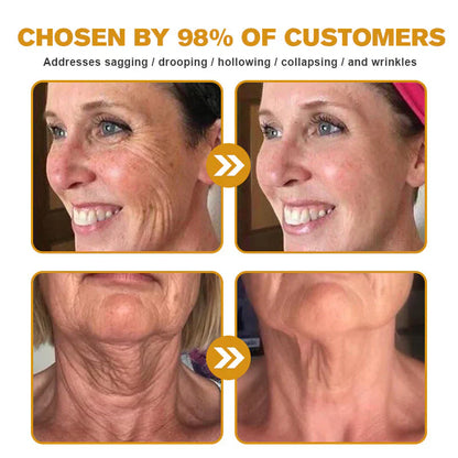 👨‍⚕️ Made and Shipped from US✅  Botox Bee Venom Wrinkle Removal Cream 20g